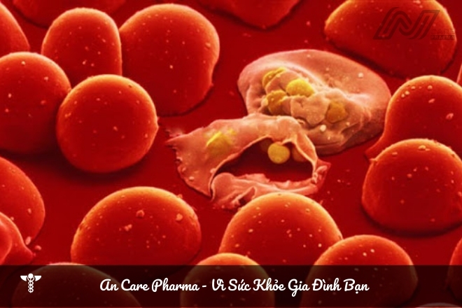 Bệnh thiếu máu do thiếu sắt