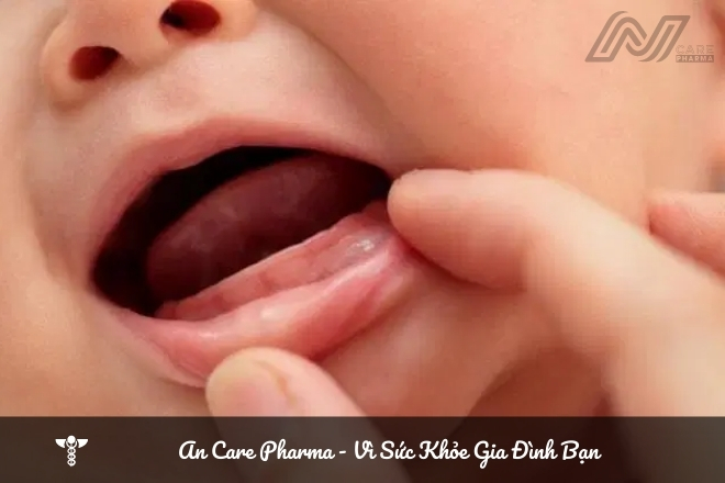 Nguyên nhân trẻ chậm mọc răng