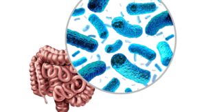 Gut microbiota and cancer