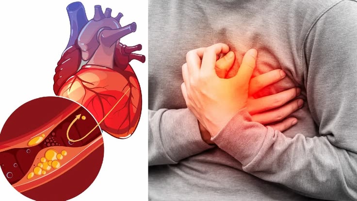 Không phải trứng là thủ phạm chính gây tăng mỡ máu