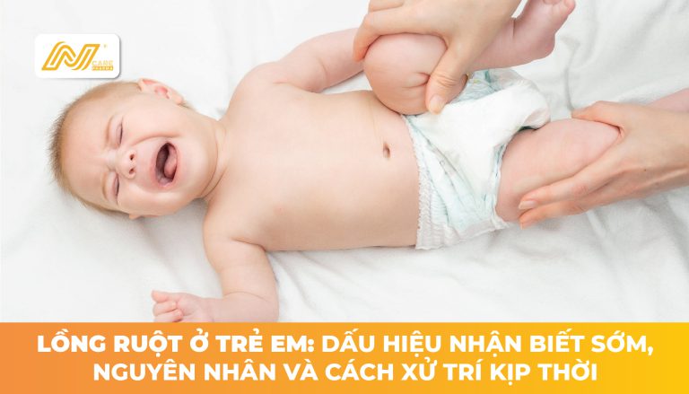 Lồng ruột ở trẻ